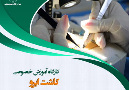 کاشت ابرو