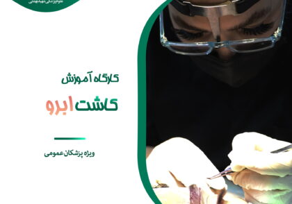 کاشت ابرو
